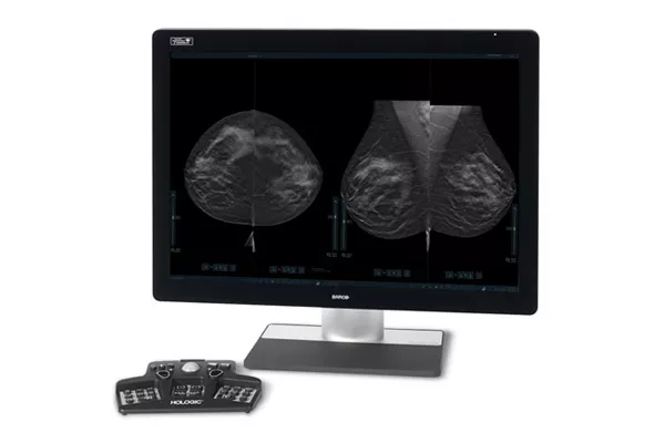 Monitor con imágenes de exploraciones mamarias y controlador sobre fondo blanco